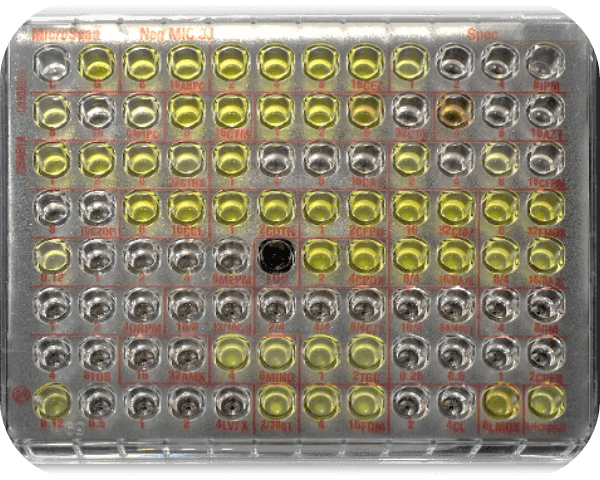 薬剤感受性検査(抗菌薬の有効性を調べる検査)